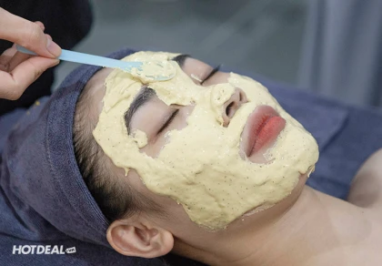 YoungMi - Nâng Cơ Trẻ Hoá, Xóa Nhăn, Làm Mờ Rãnh Cười YoungMi - Nâng Cơ Trẻ Hoá, Xóa Nhăn, Làm Mờ Rãnh Cười